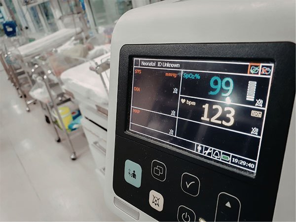 bone density monitoring
