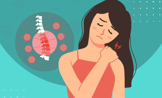 Exercise vs Medication for Osteoporosis: What the Evidence Shows