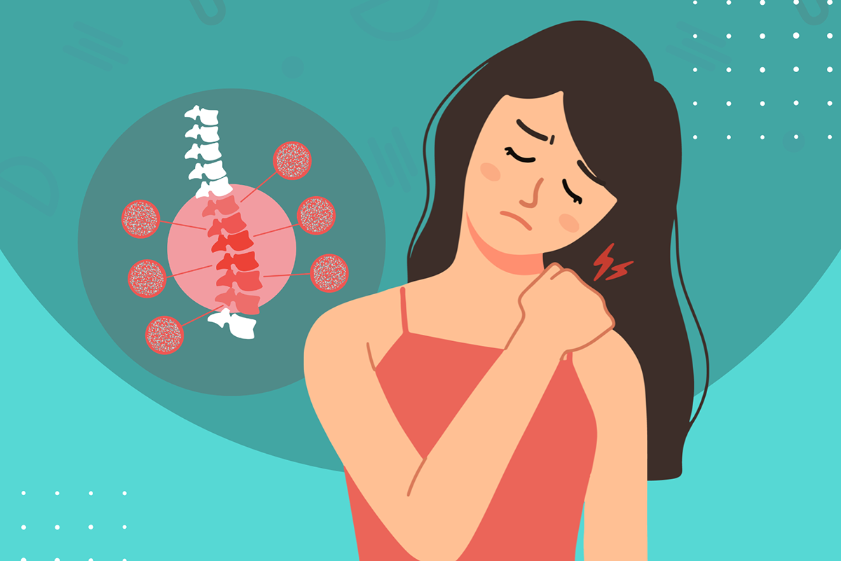 Exercise vs Medication for Osteoporosis: What the Evidence Shows